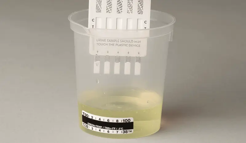 como pasar un test antidoping casero